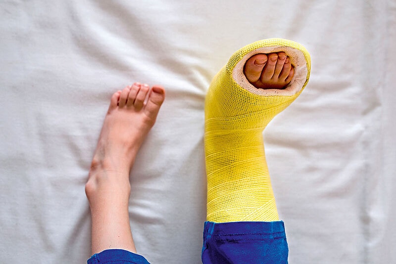 Bei einem Beinbruch unmittelbar vor der Reise bleibt die ganze Familie zu Hause. Flex-Tarife helfen hier nicht weiter, denn sie sind dann zumeist ausgelaufen